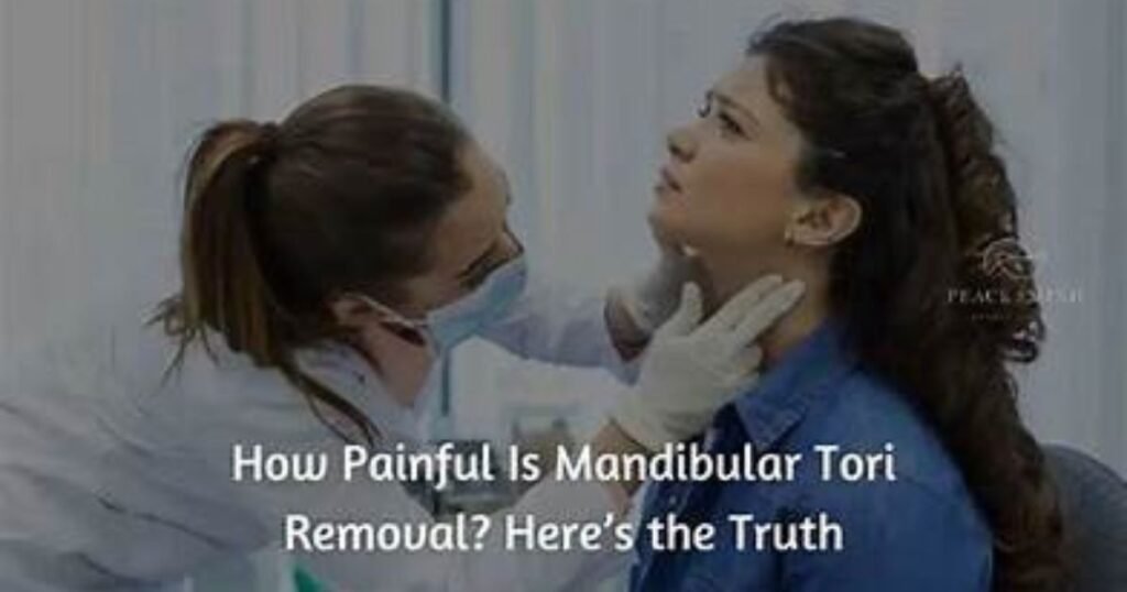 Mandibular tori removal – what to expect before and after treatment illustration